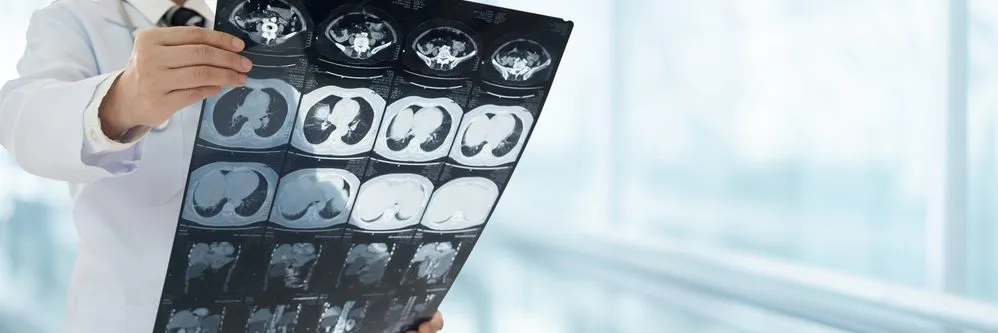 Tumore del rene: un modello di intelligenza artificiale stima il rischio prima dell'intervento chirurgico - AboutPharma